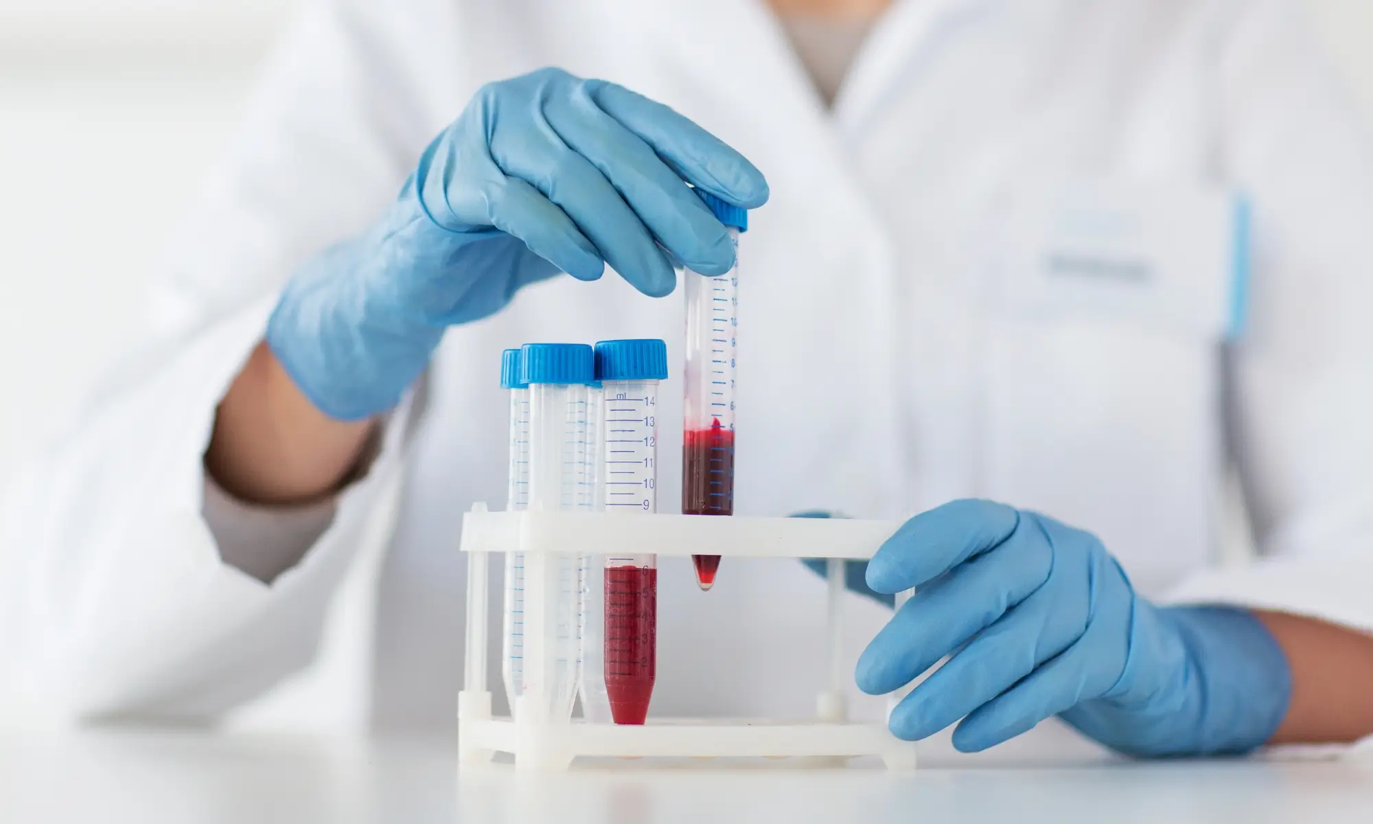 Laboratory Hazards Related to Biological Agents